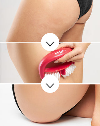 Das Anti-Cellulite-Massagegerät mit Beulen bekämpft Cellulite und reduziert Muskelverspannungen Crush my Celloo - 3