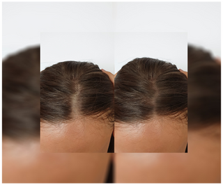 Kapseln gegen Haarausfall mit verdichtender und stärkender Wirkung Follixin 60 Kapseln - 6