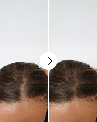 Kapseln gegen Haarausfall mit verdichtender und stärkender Wirkung Follixin 60 Kapseln_4 - 4