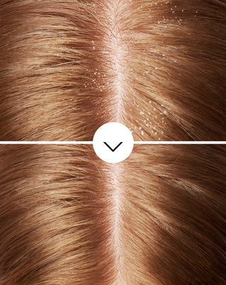 Anti-Schuppen-Shampoo von Nutridome mit Pirocton-Olamin und feuchtigkeitsspendender Wirkung - 5