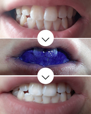 White Bite Smilebite Corrector zur Korrektur der Zahnfarbe 30 ml - 3