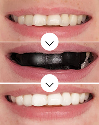 The White(ning) Stripes Smilebite Set 28 Stk. - 3