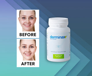 Tabletten gegen Akne, Pickel und Hautunreinheiten mit Zink, Vitamin C, E und B2 Derminax - 2