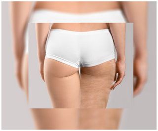 Tabletten gegen Cellulite und für Verbesserung der Kondition der Haut mit natürlichen Extrakten Cellinea 60 Kapseln - 6