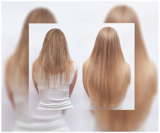 Kapseln gegen Haarausfall mit verdichtender und stärkender Wirkung Follixin 60 Kapseln