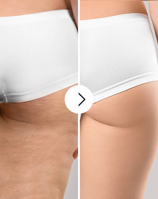 Tabletten gegen Cellulite und für Verbesserung der Kondition der Haut mit natürlichen Extrakten Cellinea 60 Kapseln_3