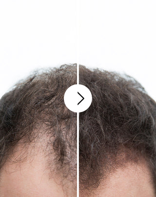 Kapseln gegen Haarausfall mit verdichtender und stärkender Wirkung Follixin 60 Kapseln_2