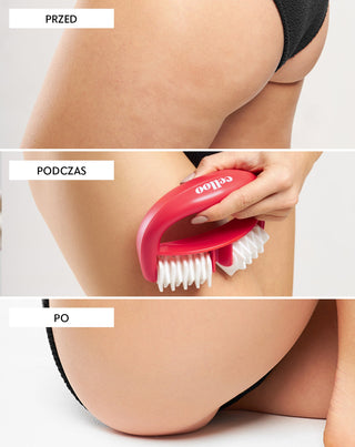 Das Anti-Cellulite-Massagegerät mit Beulen bekämpft Cellulite und reduziert Muskelverspannungen Crush my Celloo - 3